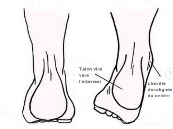 supination